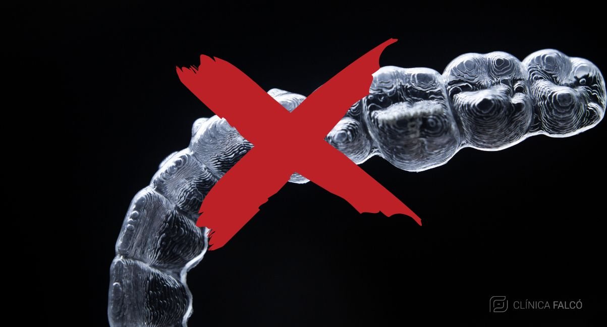 ortodoncia-invisible-cuando-no-se-puede